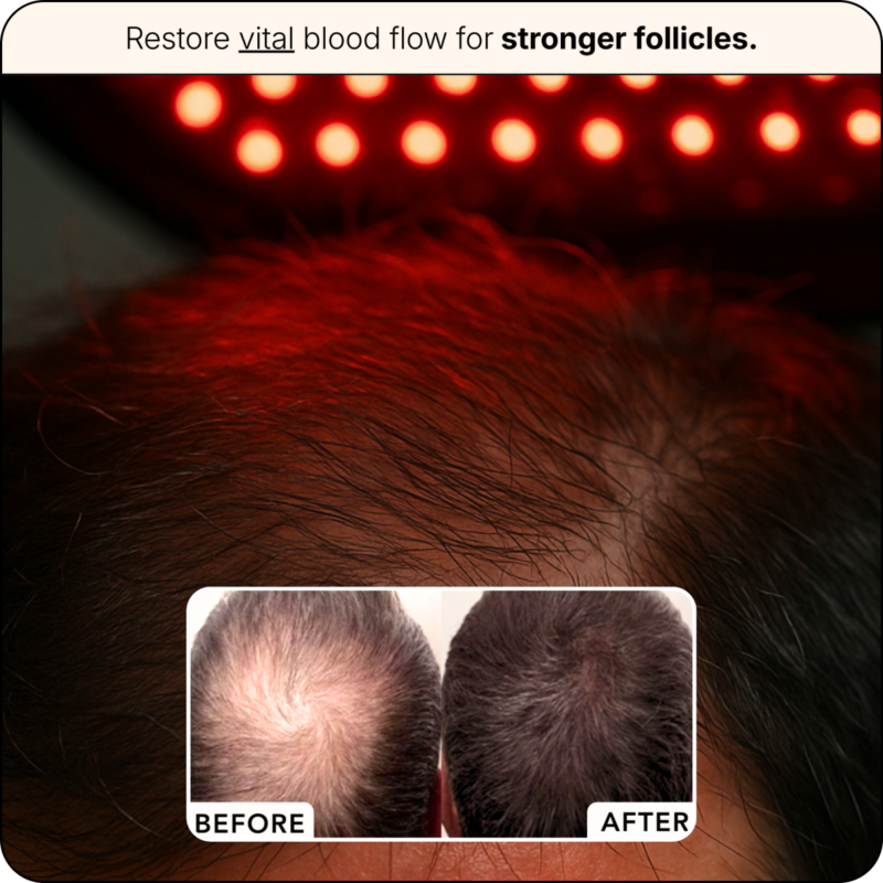 Stop Hiding Your Thinning Hair! 🚫 Experience Real Growth. ✨-edition